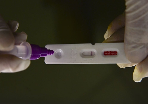 Pesquisadores identificam método capaz de prever gravidade da covid-19