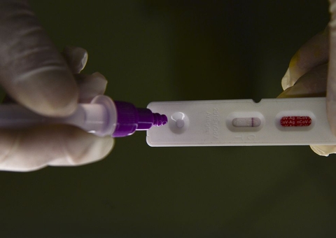 País registra 11.722 casos de covid-19 e 92 mortes em 24 horas