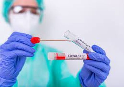Teste rápido Covid-19 custa R$ 100 mil a Codajás