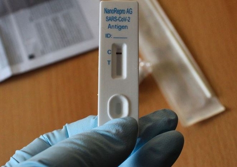 Em 24 horas, foram confirmados 82.039 novos casos de Covid no Brasil