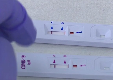 Covid: Amazonas lidera ranking de testes positivos em farmácias