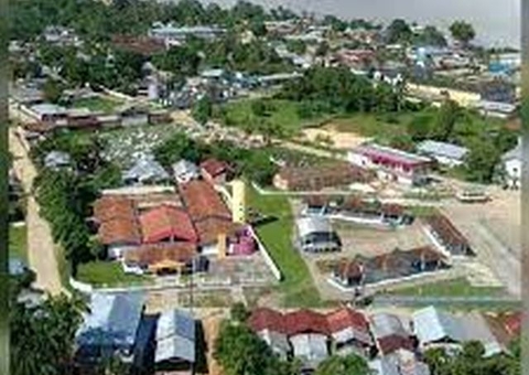 Tonantins vai adquirir equipamentos odontológicos