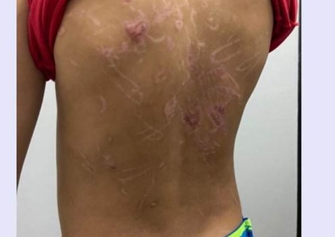 Menino de 8 anos é torturado pelo próprio pai e faz relato chocante