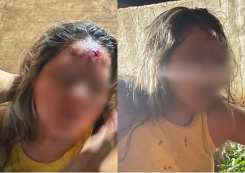 Sertanejo bate cabeça de namorada diversas vezes em parede e acaba preso