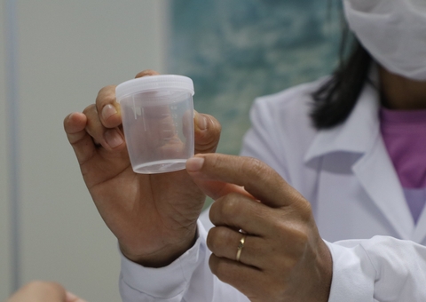 Amazonas ocupa 1º lugar em casos de Tuberculose no brasil e FVS faz alerta