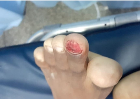 Adolescente é torturado e jogado morto na frente da casa da avó em Manaus