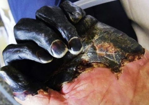 Primeira pandemia, Peste Bubônica pode ter matado um terço da população