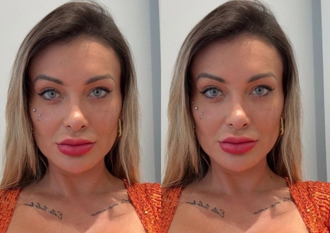 Andressa Urach relata fortes dores após cirurgia para mudar cor dos olhos