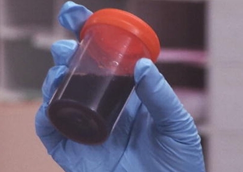 FVS confirma três casos da Doença de Haff após consumo de peixe em Itacoatiara