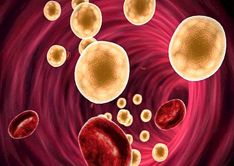 Gordura no sangue: conheça características da doença