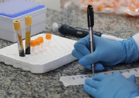 Brasil tem 20 casos registrados da variante Delta