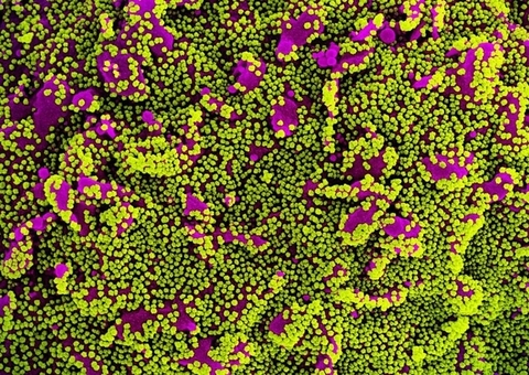 OMS diz que variante encontrada em Manaus está presente em 52 países 