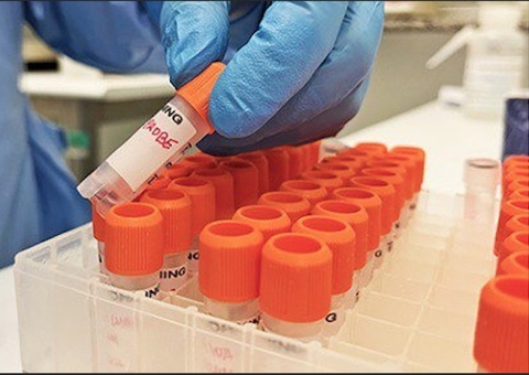 Semsa orienta unidades de saúde em como identificar varíola do macaco em Manaus