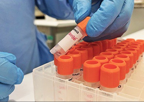 Manaus finaliza plano de contingência para o manejo de casos de varíola dos macacos