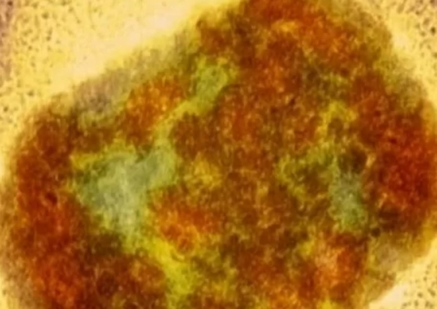 Varíola dos macacos tem risco iminente de chegar ao Brasil, diz cientista