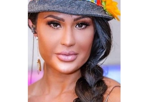 Gracyanne Barbosa impressiona com transformação no rosto: ‘afinamento’