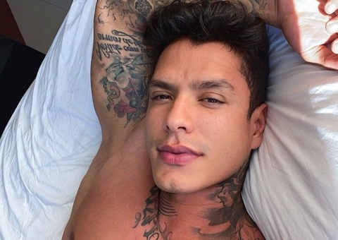 Ex de Sthe Matos faz procedimento para deixar pernas musculosas e mostra resultado