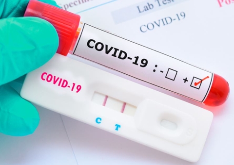 Novos casos de covid são confirmados nas Olimpíadas e situação preocupa