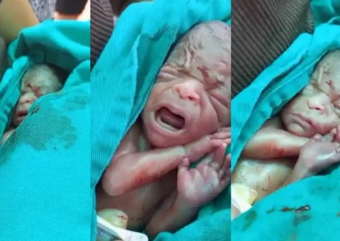 Bebê resgatado de dentro de caixão após chorar em velório morre no Acre