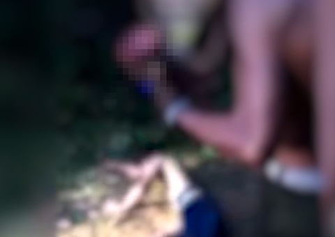 Em vídeo, pai segura pé decepado do filho e desabafa: 'Não falta comida em casa, mas você quer essa vida'