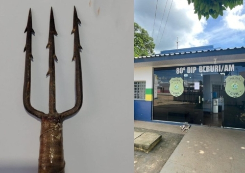 Homem vítima de tentativa de "masculinicídio"  foi atacado enquanto dormia em Beruri