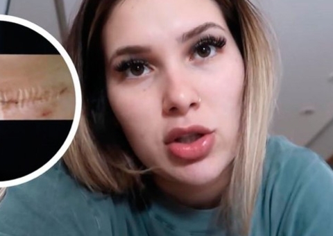 Virginia Fonseca mostra cicatriz da cesárea 18 dias após o parto