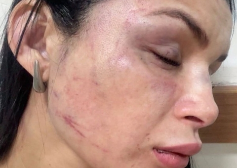 Polícia prende suspeito de agredir passageira de app no Petrópolis