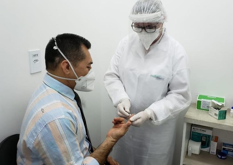 Conheça o teste que mede a imunidade pós covid-19 disponível em Manaus