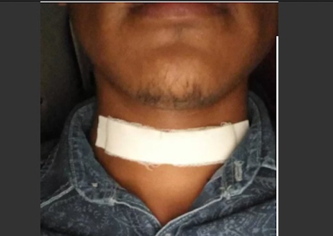 Jovem pensou que ia morrer ao ter garganta perfurada por pássaro