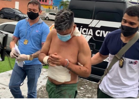 Suspeito de queimar esposa tenta se matar com faca ao ser preso em Manaus