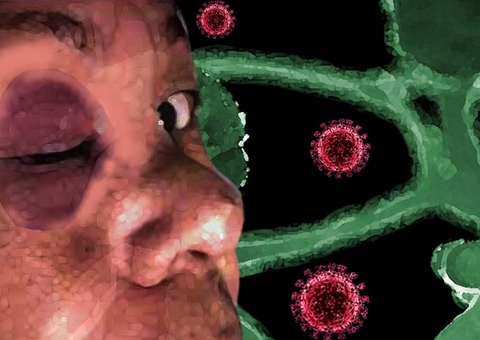 Saiba o que é ‘fungo preto’ que mutila e mata pacientes de covid na Índia