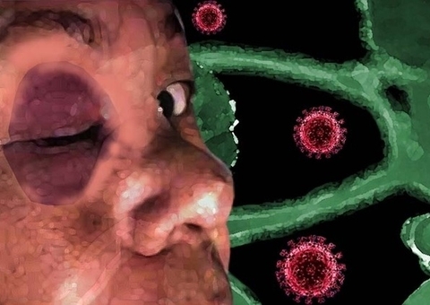 Novo caso suspeito de fungo preto é identificado no Mato Grosso do Sul