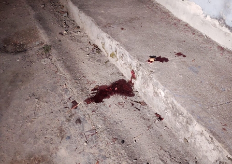 Homem leva tiro na boca durante assalto em Manaus