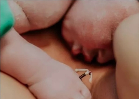 Mulher posta foto inusitada de bebê após engravidar usando DIU