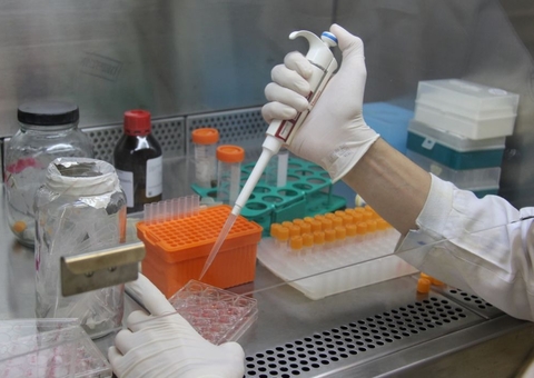 Covid-19: pesquisadores criam teste barato para unidades de saúde