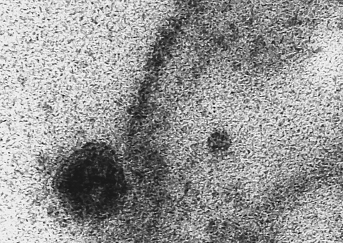 Aplicativo alimentado por tosses pode ajudar na detecção da covid-19