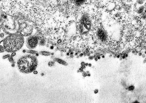 Pesquisadores desenvolvem equipamento para capturar coronavírus