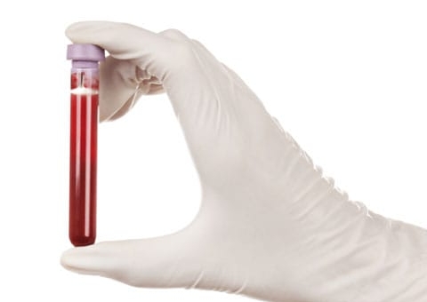 Senado proíbe discriminação a doadores de sangue homossexuais