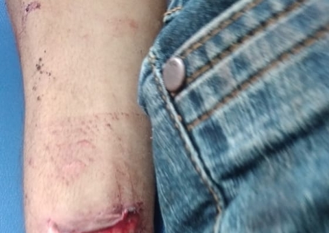 Irmãos são atacados com facão ao tirarem satisfação por morte de porco no Amazonas