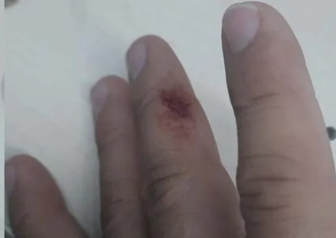 Mulher ataca policial a mordida ao tentar impedir prisão de sobrinho em Manaus