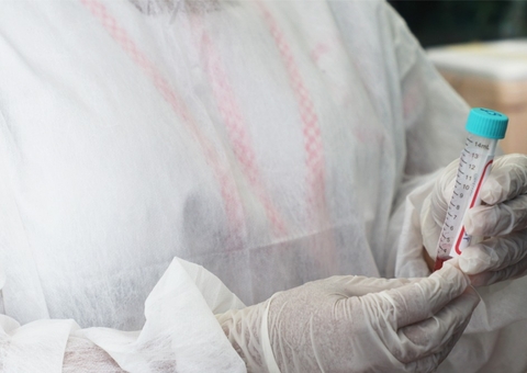 Amazonas registra 123 novos casos de Covid e duas mortes pela doença