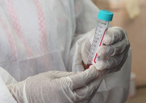 FVS confirma 64 novos casos de infectados por covid no Amazonas