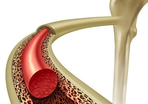 Você sabe o que é medula óssea e para que ela serve?