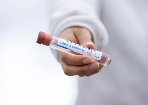 Brasil registra 77 casos da variante Ômicron