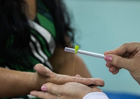 Campanha de combate à hanseníase começa na segunda em Manaus