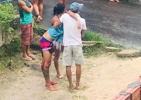 Homem é baleado na bunda ao sair para comprar comida em Manaus