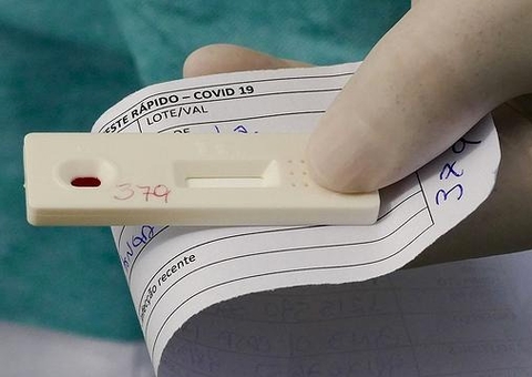 Ministério da Saúde vai pedir que Anvisa autorize autoteste de Covid no Brasil