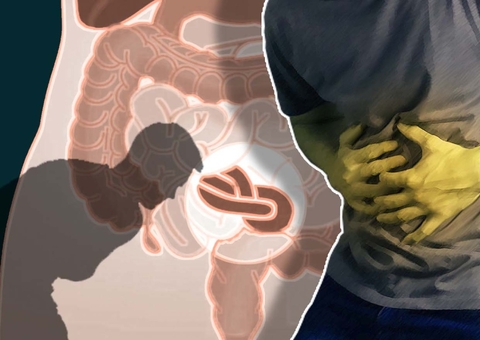 Obstrução intestinal: um problema de saúde que requer atenção redobrada