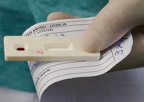 Anvisa deve aprovar autoteste de Covid nesta quarta