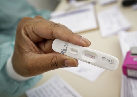 Senacon notifica empresas sobre alta de preços de testes de covid-19